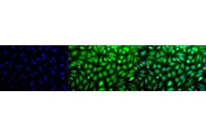 Immunocytochemistry/Immunofluorescence analysis using Rabbit Anti-Erk1/2 Polyclonal Antibody (ABIN361832 and ABIN361833).