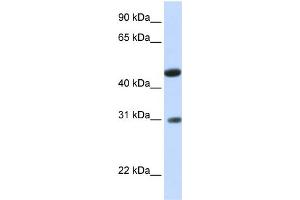 WB Suggested Anti-LOC388323 Antibody Titration:  0.