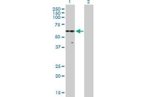 Western Blot analysis of PKNOX2 expression in transfected 293T cell line by PKNOX2 MaxPab polyclonal antibody. (PKNOX2 Antikörper  (AA 1-471))