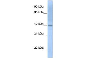 WB Suggested Anti-ITPK1 Antibody Titration: 0. (ITPK1 Antikörper  (N-Term))