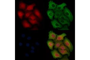ABIN6254880 and ABIN6268792 staining Hela cells by IF/ICC. (Caspase 9 Antikörper  (Cleaved-Asp330))