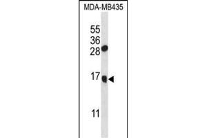 GNLY Antibody (N-term) (ABIN656999 and ABIN2846178) western blot analysis in MDA-M cell line lysates (35 μg/lane).