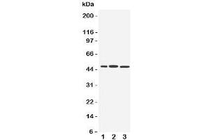 Western blot testing of IRF8 antibody and Lane 1:  human Raji;  2: rat liver;  3: (r) kidney tissue lysate. (IRF8 Antikörper  (C-Term))