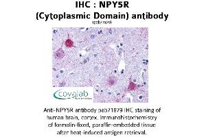 Image no. 1 for anti-Neuropeptide Y Receptor Y5 (NPY5R) (1st Cytoplasmic Domain) antibody (ABIN1737487) (NPY5R Antikörper  (1st Cytoplasmic Domain))
