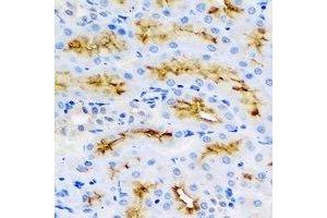 Immunohistochemical analysis of BMP15 staining in rat kidney formalin fixed paraffin embedded tissue section. (BMP15 Antikörper)