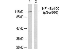 Western Blotting (WB) image for anti-Nuclear Factor of kappa Light Polypeptide Gene Enhancer in B-Cells 2 (NFKB2) (pSer866) antibody (ABIN7138717)