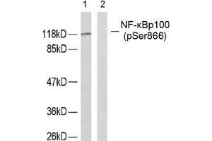 Western blot analysis of extracts from ovary cancer cells using NF-κ,B p100 (phospho-Ser866) antibody. (NFKB2 Antikörper  (pSer866))