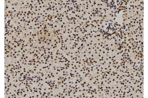 ABIN6272913 at 1/100 staining Mouse kidney tissue by IHC-P. (DDX21 Antikörper  (Internal Region))