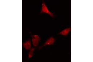 ABIN6274116 staining HeLa cells by IF/ICC. (DKC1 Antikörper  (Internal Region))
