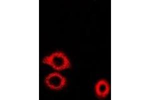 Immunofluorescent analysis of ADE2 staining in U2OS cells. (PAICS Antikörper)