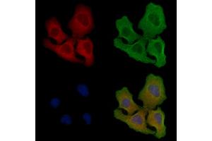 ABIN6258909 and ABIN6275877 staining Hela cells by IF/ICC. (IREM1 Antikörper  (Internal Region))