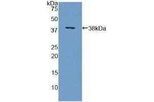 Detection of Recombinant MBP, Human using Polyclonal Antibody to Myelin Basic Protein (MBP)
