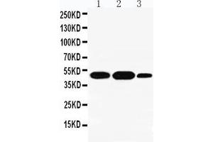 Anti-INDOL1 antibody, Western blotting Lane 1: A549 Cell Lysate Lane 2: Human Placenta Tissue Lysate Lane 3: A431 Cell Lysate (IDO2 Antikörper  (N-Term))