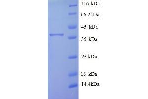 SDS-PAGE (SDS) image for Transmembrane Protein 14B (TMEM14B) (AA 1-114), (full length) protein (GST tag) (ABIN5710508) (TMEM14B Protein (AA 1-114, full length) (GST tag))