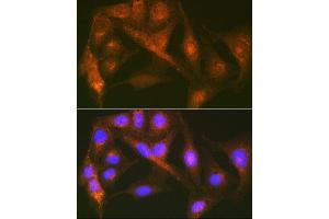 Immunofluorescence analysis of U-2 OS cells using Cortactin Rabbit mAb (ABIN7266511) at dilution of 1:100 (40x lens). (Cortactin Antikörper)