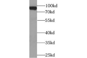 Western blot analysis of HEK-293 cells were subjected to SDS PAGE using BACH1 antibody at dilution of 1/1000. (BACH1 Antikörper)