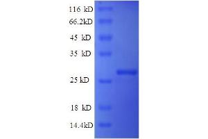 SDS-PAGE (SDS) image for Reelin (RELN) (AA 26-254), (partial) protein (His tag) (ABIN5710244) (Reelin Protein (RELN) (AA 26-254, partial) (His tag))