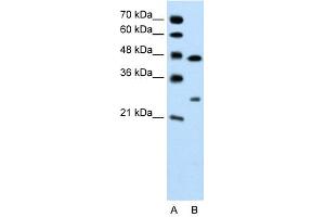 Western Blot showing Claudin 18 antibody used at a concentration of 1-2 ug/ml to detect its target protein. (Claudin 18 Antikörper  (C-Term))