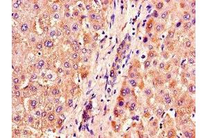 Immunohistochemistry of paraffin-embedded human liver tissue using ABIN7162949 at dilution of 1:100 (ACOX1 Antikörper  (AA 113-273))