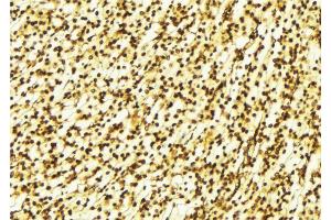 ABIN6269286 at 1/100 staining Human gastric tissue by IHC-P.