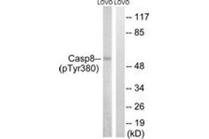Western blot analysis of extracts from LOVO cells treated with UV 15', using Caspase 8 (Phospho-Tyr380) Antibody. (Caspase 8 Antikörper  (pTyr380))