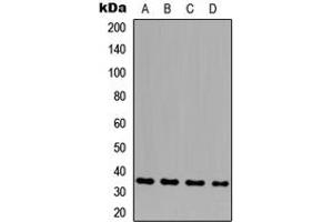 Western blot analysis of GLB1L3 expression in HeLa (A), THP1 (B), NS-1 (C), H9C2 (D) whole cell lysates. (GLB1L3 Antikörper  (Center))