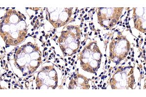 Detection of CASP10 in Human Colon Tissue using Polyclonal Antibody to Caspase 10 (CASP10) (Caspase 10 Antikörper  (AA 223-459))