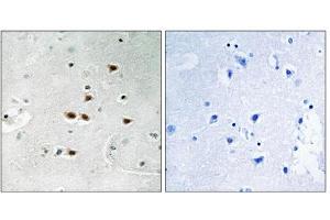 Immunohistochemistry analysis of paraffin-embedded human brain tissue using ITCH (Phospho-Tyr420) antibody. (ITCH Antikörper  (pTyr420))