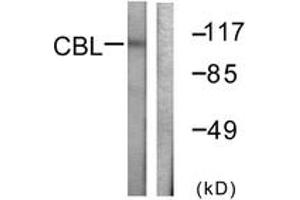 Western blot analysis of extracts from HeLa cells, treated with EGF 200ng/ml 30', using CBL (Ab-774) Antibody. (CBL Antikörper  (AA 740-789))