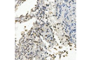 IHC analysis of FOXF1 using anti-FOXF1 antibody (ABIN7601744). (FOXF1 Antikörper  (AA 44-379))