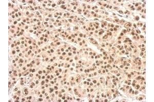 IHC-P Image XRCC4 antibody detects XRCC4 protein at nucleus on HBL435 xenograft by immunohistochemical analysis. (XRCC4 Antikörper  (C-Term))