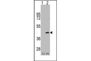 Image no. 1 for anti-Mitogen-Activated Protein Kinase Kinase 4 (MAP2K4) (Ser257) antibody (ABIN360303) (MAP2K4 Antikörper  (Ser257))