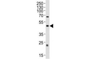 Western blot analysis of lysate from human brain tissue lysate using ABHD12 antibody diluted at 1:1000. (ABHD12 Antikörper  (AA 40-66))