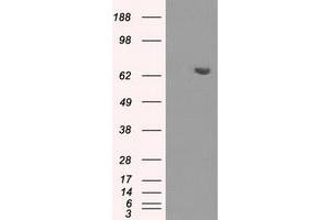 HEK293T cells were transfected with the pCMV6-ENTRY control (Left lane) or pCMV6-ENTRY HDAC10 (Right lane) cDNA for 48 hrs and lysed. (HDAC10 Antikörper)