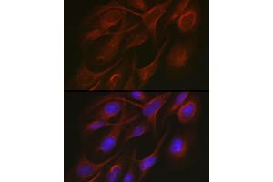Immunofluorescence analysis of U2OS cells using TR antibody (ABIN3023477, ABIN3023478, ABIN3023479 and ABIN6220053) at dilution of 1:50. (TRAF7 Antikörper)