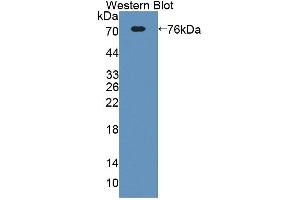 Western blot analysis of the recombinant protein. (ECM1 Antikörper  (AA 20-434))