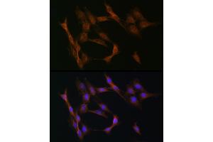 Immunofluorescence analysis of C6 cells using TGF beta Receptor II (TGF beta Receptor II (TGFBR2)) Rabbit pAb (ABIN6130734, ABIN6149084, ABIN6149087 and ABIN6215460) at dilution of 1:50 (40x lens). (TGFBR2 Antikörper  (AA 23-280))