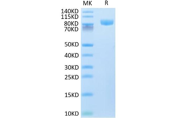 VCAM1 Protein (AA 25-697) (His tag)