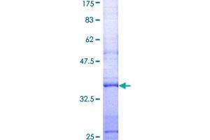 Image no. 1 for Lysozyme (LYZ) (AA 19-118) protein (GST tag) (ABIN1309957) (LYZ Protein (AA 19-118) (GST tag))