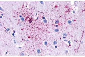 Anti-GPR139 antibody  ABIN1048723 IHC staining of human brain, neurons and glia.