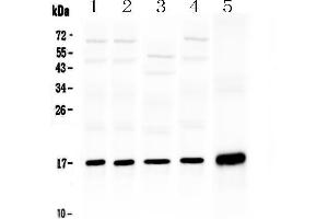 Western blot analysis of Hsp20 using anti-Hsp20 antibody .