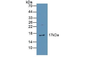 Western blot analysis of recombinant Human CAT. (Catalase Antikörper  (AA 32-167))