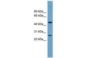 Image no. 1 for anti-Elongator Acetyltransferase Complex Subunit 4 (ELP4) (AA 101-150) antibody (ABIN6744601) (ELP4 Antikörper  (AA 101-150))