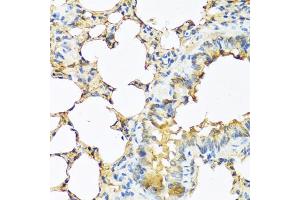 Immunohistochemistry of paraffin-embedded mouse lung using TSHB antibody (ABIN6132751, ABIN6149620, ABIN6149621 and ABIN6222522) at dilution of 1:100 (40x lens). (TSHB Antikörper  (AA 21-138))