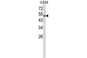 Western blot analysis of PTGIS Antibody (C-term) Cat.