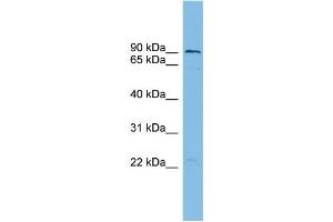 WB Suggested Anti-TBC1D16 Antibody Titration: 0. (TBC1D16 Antikörper  (N-Term))
