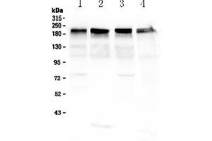 Laminin gamma 1 Antikörper  (all Isoforms)