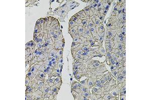 Immunohistochemistry of paraffin-embedded human stomach using Carbonic Anhydrase 9 (C/G250) antibody (ABIN6131266, ABIN6137798, ABIN6137800 and ABIN6217767) at dilution of 1:100 (40x lens). (CA9 Antikörper  (AA 52-151))