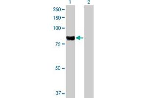 Western Blot analysis of PLA2G6 expression in transfected 293T cell line by PLA2G6 MaxPab polyclonal antibody. (PLA2G6 Antikörper  (AA 1-752))