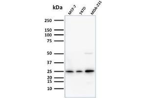 Western Blot Analysis of Human MCF-7,T47D and MDA-231 cell lysate using Monospecific Mouse Monoclonal Antibody (SPM518) to Mammaglobin. (Mammaglobin A Antikörper)